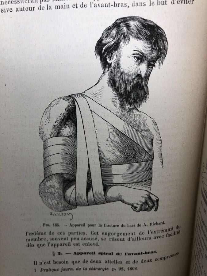 JAMAIN (M.A). - Manuel de petite chirurgie. Édité à Paris chez Felix Alcan en 1…