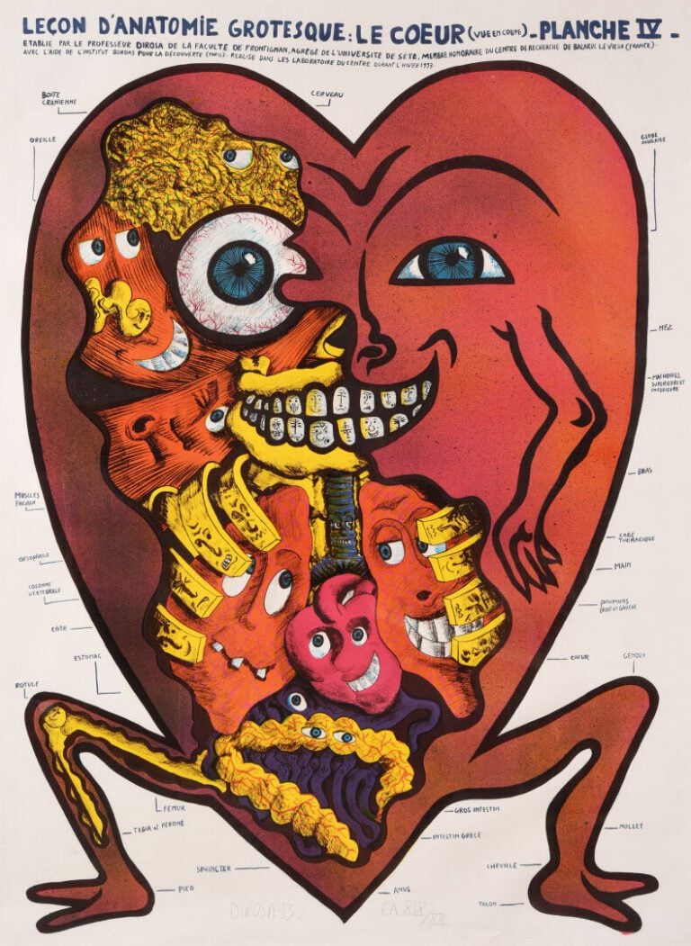 Hervé DI ROSA (1959) - "Leçon d'anatomie grotesque : le coeur" - Lithographie s…