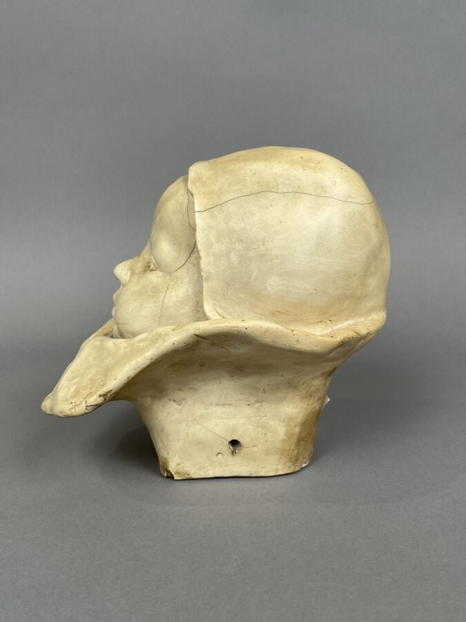 TETE DE BEBE en plâtre patiné (fentes, manques) - Hauteur : 16 cm - Provient de…